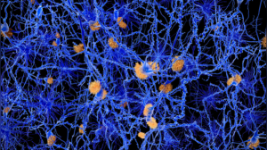 Stress and Your Lymphatic System: 4 Ways Anxiety Can Disrupt Detoxification and Immunity