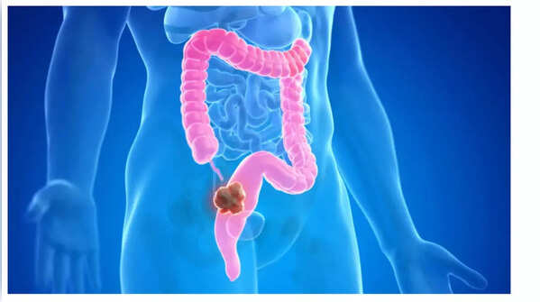 Illustration of unexplained weight loss