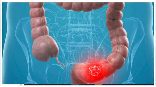Illustration of a person holding their stomach in pain